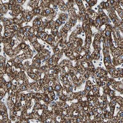 Immunohistochemistry-Paraffin: ECH1 Antibody [NBP1-83215] - Staining of human liver shows strong cytoplasmic positivity in a granular pattern in hepatocytes.