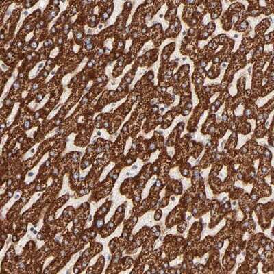 Immunohistochemistry-Paraffin: ECH1 Antibody [NBP1-83216] - Staining of human liver shows strong cytoplasmic positivity in hepatocytes.