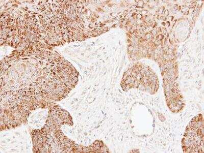 Immunohistochemistry-Paraffin: ECH1 Antibody [NBP2-16261] - ECH1 antibody detects ECH1 protein at mitochondrion on Cal27 xenograft by immunohistochemical analysis. Sample: Paraffin-embedded Cal27 xenograft. ECH1 antibody dilution: 1:500.