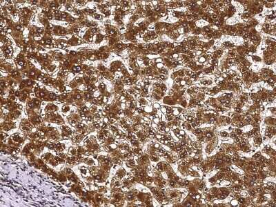 Immunohistochemistry-Paraffin: ECH1 Antibody [NBP3-00324] - Immunochemical staining of human ECH1 in human liver(cirrhosis) with rabbit polyclonal antibody (1:10000, formalin-fixed paraffin embedded sections). Positive staining was localized to cytoplasm of hepatocyte