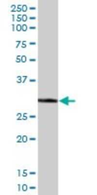 Western Blot: ECH1 Antibody [H00001891-B01P] - Analysis of ECH1 expression in human liver.