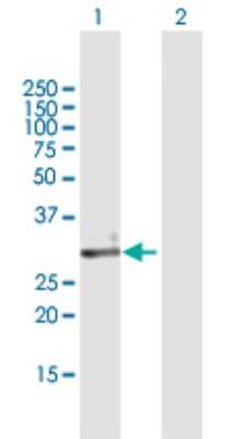 Western Blot: ECH1 Antibody [H00001891-B01P] - Analysis of ECH1 expression in transfected 293T cell line by ECH1 polyclonal antibody.  Lane 1: ECH1 transfected lysate(36.08 KDa). Lane 2: Non-transfected lysate.