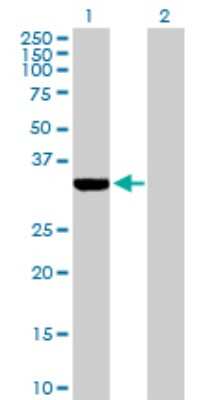 Western Blot: ECH1 Antibody [H00001891-D01P] - Analysis of ECH1 expression in transfected 293T cell line by ECH1 polyclonal antibody.Lane 1: ECH1 transfected lysate(35.80 KDa).Lane 2: Non-transfected lysate.