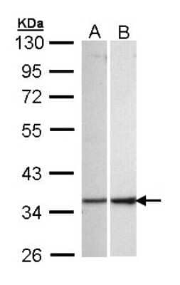 Western Blot: ECH1 Antibody [NBP1-31662] - Sample (30 ug of whole cell lysate) A: 293T B: Hep G2 10% SDS PAGE; antibody diluted at 1:1000.