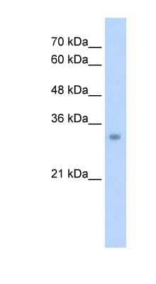 Western Blot: ECH1 Antibody [NBP1-54738] - Titration: 2.5ug/ml Positive Control: HepG2 cell lysate.