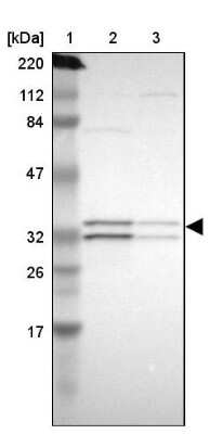 Western Blot: ECH1 Antibody [NBP1-83215] - Lane 1: Marker  [kDa] 220, 112, 84, 47, 32, 26, 17.  Lane 2: Human cell line RT-4.  Lane 3: Human cell line U-251MG sp