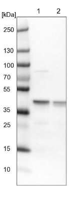 Western Blot: ECH1 Antibody [NBP1-83215] - Lane 1: NIH-3T3 cell lysate (Mouse embryonic fibroblast cells)Lane 2: NBT-II cell lysate (Rat Wistar bladder tumour cells)