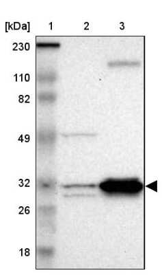 Western Blot: ECH1 Antibody [NBP1-83216] - Lane 1: Marker  [kDa] 230, 110, 82, 49, 32, 26, 18.   Lane 2: Human cell line RT-4.  Lane 3: Human cell line U-251MG sp