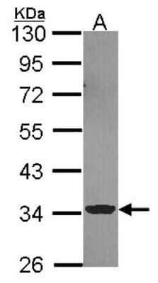 Western Blot: ECH1 Antibody [NBP2-16261] - Sample (30 ug of whole cell lysate) A: A549 10% SDS PAGE gel, diluted at 1:1000.