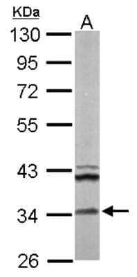 Western Blot: ECH1 Antibody [NBP2-16261] - Sample (50 ug of whole cell lysate) A: Mouse Brain, 10% SDS PAGE gel, diluted at 1:1000.