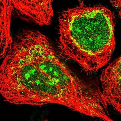 Immunocytochemistry/Immunofluorescence: ECHDC3 Antibody [NBP1-82159] - Staining of human cell line A-431 shows positivity in nucleus, nucleoli and mitochondria. Antibody stainng is shown in green.