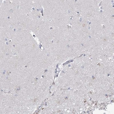 Immunohistochemistry-Paraffin: ECHDC3 Antibody [NBP1-82159] - Staining of human cerebral cortex shows low expression as expected.
