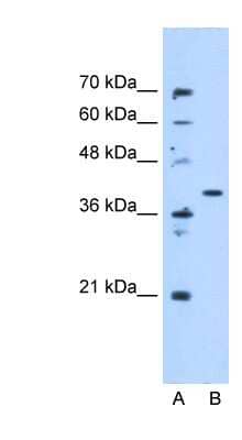 Western Blot: ECHDC3 Antibody [NBP1-79302] - HepG2 cell lysate, concentration 5.0ug/ml.