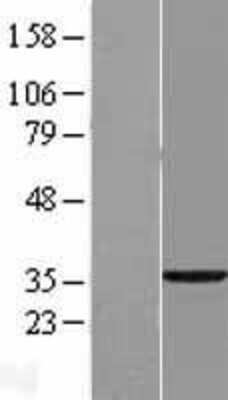 Western Blot: ECHDC3 Overexpression Lysate (Adult Normal) [NBL1-10099] Left-Empty vector transfected control cell lysate (HEK293 cell lysate); Right -Over-expression Lysate for ECHDC3.