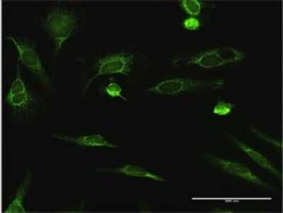 Immunocytochemistry/Immunofluorescence: ECHS1 Antibody [H00001892-D01P] - Analysis of antibody to ECHS1 on HeLa cell. Antibody concentration 10 ug/ml.