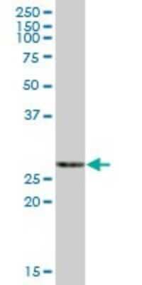 Western Blot: ECHS1 Antibody [H00001892-B01P] - Analysis of ECHS1 expression in human liver.