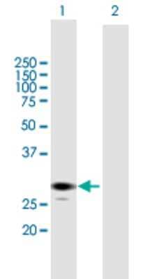 Western Blot: ECHS1 Antibody [H00001892-B01P] - Analysis of ECHS1 expression in transfected 293T cell line by ECHS1 polyclonal antibody.  Lane 1: ECHS1 transfected lysate(31.9 KDa). Lane 2: Non-transfected lysate.