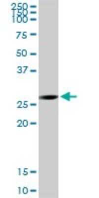 Western Blot: ECHS1 Antibody [H00001892-D01P] - Analysis of ECHS1 expression in human liver.