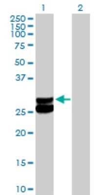 Western Blot: ECHS1 Antibody [H00001892-D01P] - Analysis of ECHS1 expression in transfected 293T cell line by ECHS1 polyclonal antibody.Lane 1: ECHS1 transfected lysate(31.40 KDa).Lane 2: Non-transfected lysate.