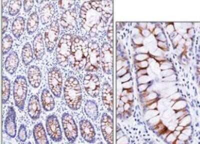 Immunohistochemistry-Paraffin: ECM-1/Secretory Component P85 Antibody (SC05) [NBP2-29464] - Secretory Component / ECM1 Antibody (SC05) [NBP2-29464] - Staining of normal human small intestine. Note cytoplasmic and membrane staining.