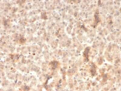 Immunohistochemistry-Paraffin: ECM-1/Secretory Component P85 Antibody (rSPM217) - Azide and BSA Free [NBP3-08403] - Formalin-fixed, paraffin-embedded human liver stained with ECM-1/Secretory Component P85 Recombinant Mouse Monoclonal Antibody (rSPM217).