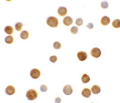 Immunocytochemistry/Immunofluorescence: ECRG4 Antibody [NBP2-81925] - Analysis of ECRG4 in HeLa cells with ECRG4 antibody at 5 ug/ml.