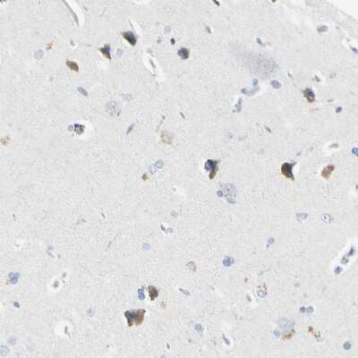 Immunohistochemistry-Paraffin ECRG4 Antibody - BSA Free