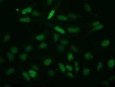 Flow Cytometry: ECRG4 Antibody (OTI3B10) - Azide and BSA Free [NBP2-72294] - Staining of HeLa cells using anti-ECRG4 mouse monoclonal antibody.