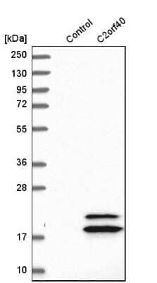 Western Blot ECRG4 Antibody - BSA Free
