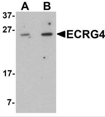 Western Blot: ECRG4 Antibody [NBP2-81925] - Analysis of ECRG4 in HeLa cell lysate with ECRG4 antibody at (A) 1 and (B) 2 ug/ml.