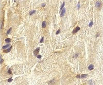 Immunohistochemistry-Paraffin: ECSIT Antibody [NBP1-76594] - Mouse heart cells with ECSIT antibody at 2 ug/ml.