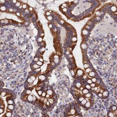 Immunohistochemistry-Paraffin ECSIT Antibody