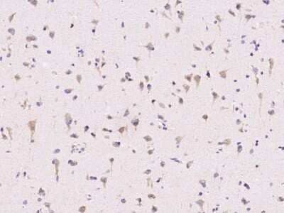 Immunohistochemistry-Paraffin: ECSIT Antibody [NBP3-00303] - Immunochemical staining of human ECSIT in human brain with rabbit polyclonal antibody (1:25000, formalin-fixed paraffin embedded sections).