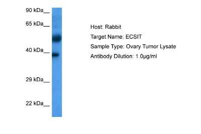 Western Blot: ECSIT Antibody [NBP2-87321] - Host: Rabbit. Target Name: ECSIT. Sample Tissue: Ovary Tumor lysates. Antibody Dilution: 1ug/ml