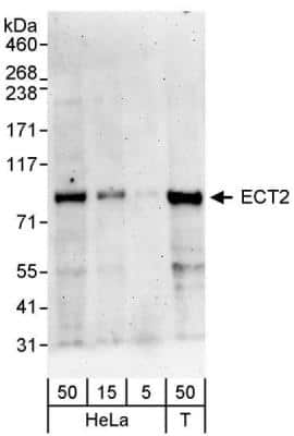 <b>Biological Strategies Validation. </b>Western Blot: ECT2 Antibody [NBP1-28729] - Whole cell lysate (5, 15 and 50 ug) from HeLa cells. Antibody used for WB at 0.1 ug/ml.