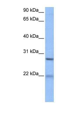 Western Blot: ECT2 Antibody [NBP1-58303] - HepG2 cell lysate, concentration 0.2-1 ug/ml.