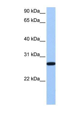 Western Blot: ECT2 Antibody [NBP1-58321] - Hela cell lysate, concentration 0.2-1 ug/ml.
