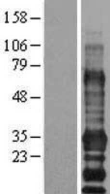 Western Blot: EDARADD Overexpression Lysate (Adult Normal) [NBL1-10107] Left-Empty vector transfected control cell lysate (HEK293 cell lysate); Right -Over-expression Lysate for EDARADD.