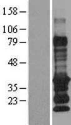 Western Blot: EDARADD Overexpression Lysate (Adult Normal) [NBP2-09960] Left-Empty vector transfected control cell lysate (HEK293 cell lysate); Right -Over-expression Lysate for EDARADD.