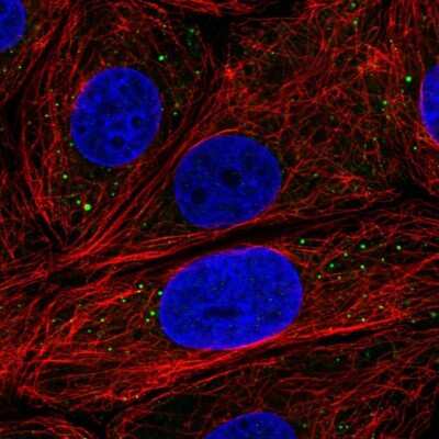 Immunocytochemistry/Immunofluorescence: EDC3 Antibody [NBP2-57115] - Staining of human cell line MCF7 shows localization to cytoplasmic bodies. antibody staining is shown in green.