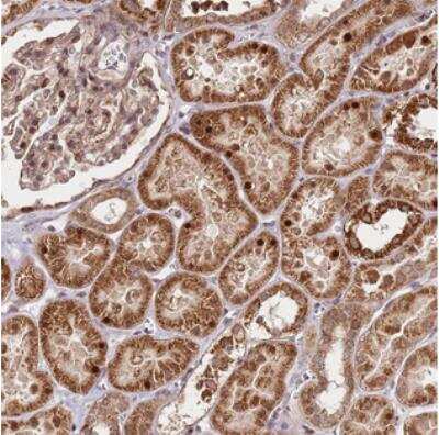 Immunohistochemistry: EDC3 Antibody [NBP2-30696] - Staining of human kidney shows strong cytoplasmic and nuclear positivity in renal tubules.