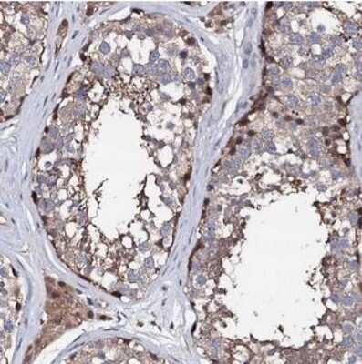 Immunohistochemistry-Paraffin EDC3 Antibody - BSA Free