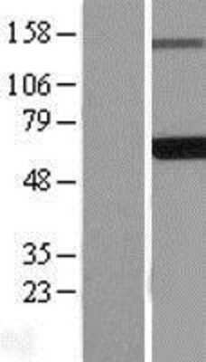 Western Blot EDC3 Overexpression Lysate