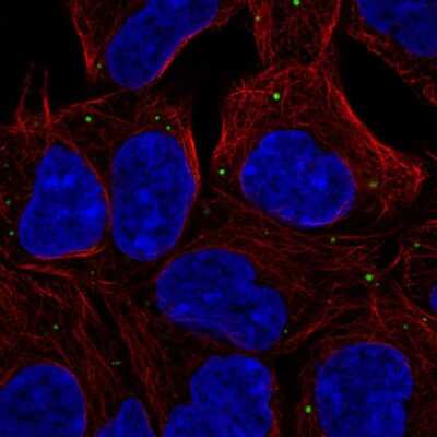 Immunocytochemistry/Immunofluorescence: EDC4 Antibody [NBP2-55530] - Staining of human cell line HEK 293 shows localization to cytoplasmic bodies.