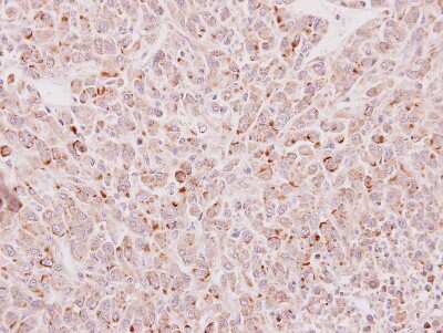 Immunohistochemistry-Paraffin: EDC4 Antibody [NBP2-16267] - Immunohistochemical analysis of paraffin-embedded U87 xenograft, using antibody at 1:100 dilution.