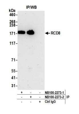 Immunoprecipitation: EDC4 Antibody [NB100-2273] - Detection of human RCD8 by western blot of immunoprecipitates. Samples: Whole cell lysate (1.0 mg per IP reaction; 20% of IP loaded) from HeLa cells prepared using NETN lysis buffer. Antibodies: Affinity purified rabbit anti-RCD8 antibody NB100-2273 (lot NB100-2273-2) used for IP at 6 ug per reaction. RCD8 was also immunoprecipitated by a previous lot of this antibody (lot NB100-2273-1). For blotting immunoprecipitated RCD8, A300-745A was used at 0.2 ug/ml. Detection: Chemiluminescence with an exposure time of 3 minutes.