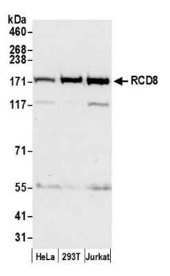 Western Blot: EDC4 Antibody [NB100-2273] - Detection of human RCD8 by western blot. Samples: Whole cell lysate (50 ug) from HeLa, HEK293T, and Jurkat cells prepared using NETN lysis buffer. Antibody: Affinity purified rabbit anti-RCD8 antibody NB100-2273 used for WB at 0.1 ug/ml. Detection: Chemiluminescence with an exposure time of 10 seconds.