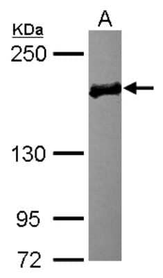 Western Blot: EDC4 Antibody [NBP2-16267] - Sample (30 ug of whole cell lysate) A: MCF-7 5% SDS PAGE gel, diluted at 1:3000.