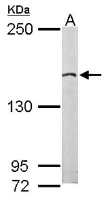 Western Blot: EDC4 Antibody [NBP2-16267] - Sample (50 ug of whole cell lysate) A: Mouse Brain, 5% SDS PAGE gel, diluted at 1:2000.