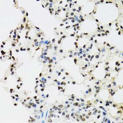 Immunohistochemistry-Paraffin: EDF1 Antibody [NBP2-92882] - Mouse lung using EDF1 antibody at dilution of 1:100 (40x lens).